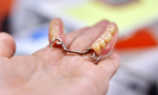 The Advantages of Choosing a Skilled Dental Implant Specialist