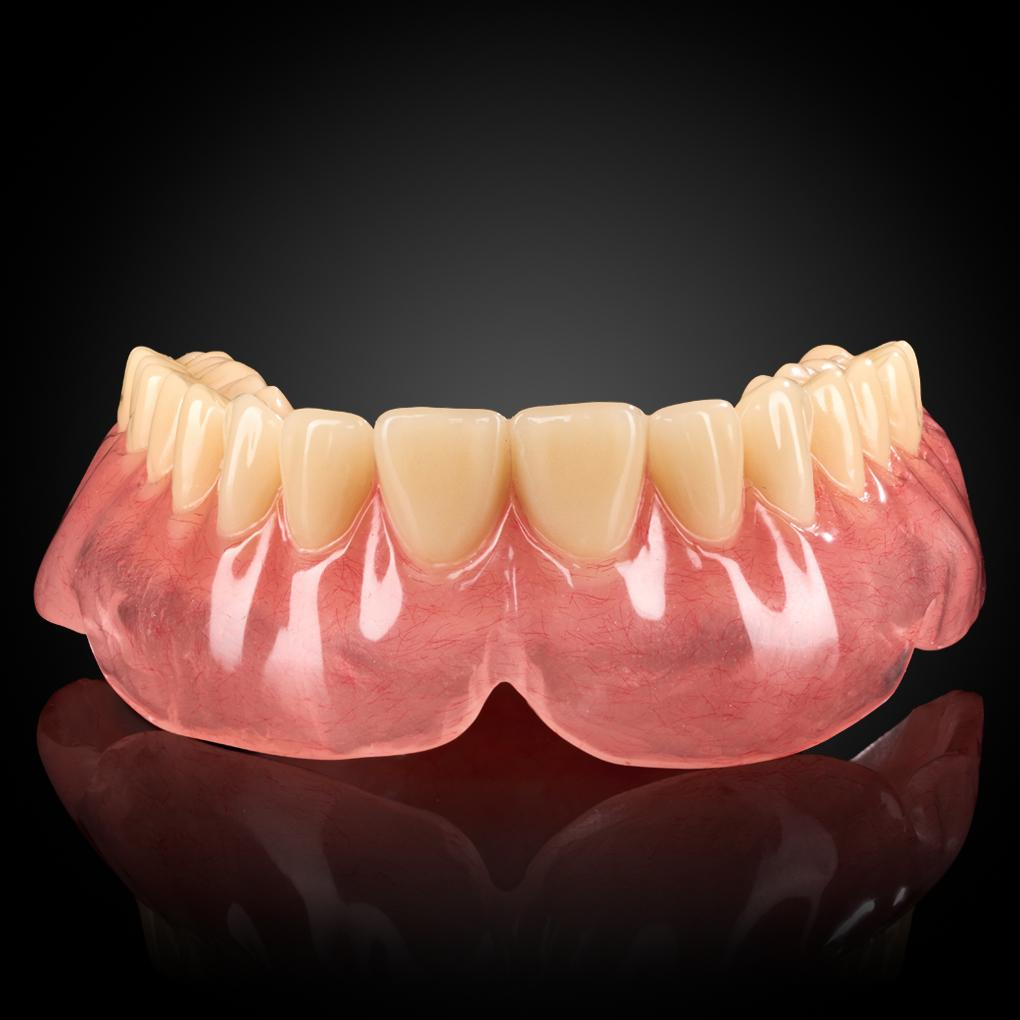 Dental Implant in Korea: Affordable, Advanced, and Reliable